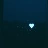 หัวใจล้มเหลว(Heart Failure)